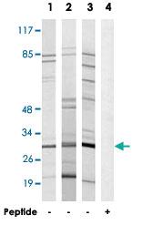 Anti-RPS8 Rabbit Polyclonal Antibody