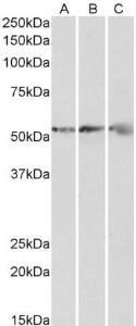 Anti-ATP5B Antibody (A85199) (0.3 µg/ml) staining of Human (A), Mouse (B) and Rat (C) Heart lysates (35 µg protein in RIPA buffer). Primary incubation was 1 hour. Detected by chemiluminescence