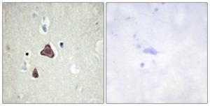 Antibody anti-ADCY8 100 µg