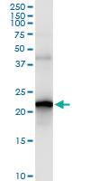 Anti-VIMP Rabbit Polyclonal Antibody