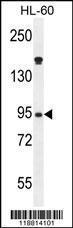 Anti-MPO Rabbit Polyclonal Antibody (AP (Alkaline Phosphatase))