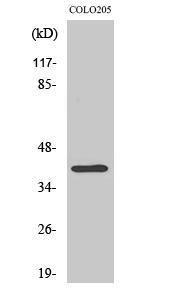 Western blot analysis of various cells using Anti-DOK6 Antibody