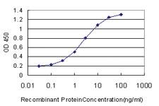 Anti-RUNX2 Mouse Monoclonal Antibody [clone: 2B9]