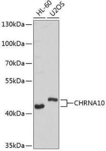 Western blot analysis of extracts of various cell lines, using Anti-CHRNA10 Antibody (A9137) at 1:1,000 dilution