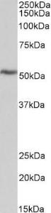 Anti-ATP5B Antibody (A85199) (0.3 µg/ml) staining of Pig Heart lysate (35 µg protein in RIPA buffer). Primary incubation was 1 hour. Detected by chemiluminescence