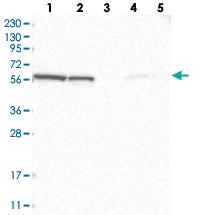 Anti-GOPC Rabbit Polyclonal Antibody