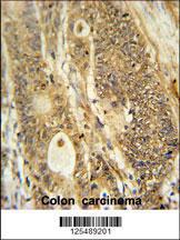 Anti-AVIL Rabbit Polyclonal Antibody (AP (Alkaline Phosphatase))