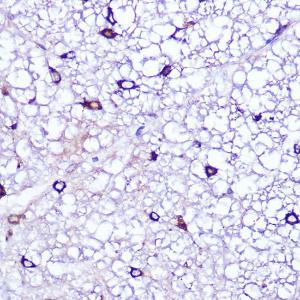 Immunohistochemistry analysis of paraffin-embedded rat spinal cord using Anti-LATS1/WARTS Antibody (A93250) at a dilution of 1:100 (40X lens). Perform microwave antigen retrieval with 10 mM Tris/EDTA buffer pH 9.0 before commencing with IHC staining protocol