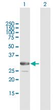 Anti-ARMC10 Mouse Polyclonal Antibody