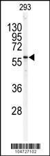 Anti-SPTLC1 Rabbit Polyclonal Antibody (HRP (Horseradish Peroxidase))