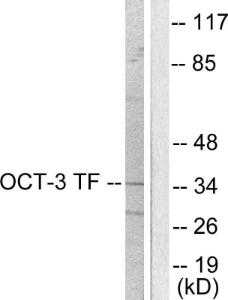 Western blot analysis of lysates from HeLa cells using Anti-OCT3 Antibody. The right hand lane represents a negative control, where the antibody is blocked by the immunising peptide