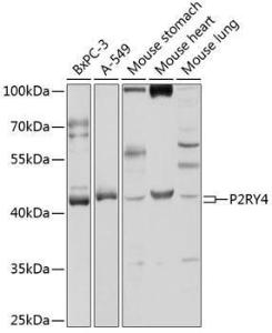 Western blot analysis of extracts of various cell lines, using Anti-P2Y4 Antibody (A9140) at 1:1,000 dilution. The secondary antibody was Goat Anti-Rabbit IgG H&L Antibody (HRP) at 1:10,000 dilution. Lysates/proteins were present at 25µg per lane.