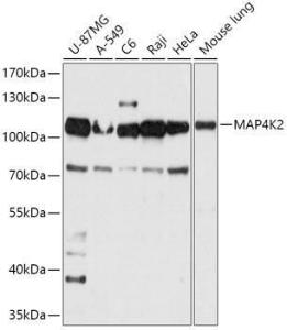 Western blot analysis of extracts of various cell lines, using Anti-Ger minal Center Kinase/GCK Antibody (A309153) at 1:1000 dilution. The secondary Antibody was Goat Anti-Rabbit IgG H&L Antibody (HRP) at 1:10000 dilution