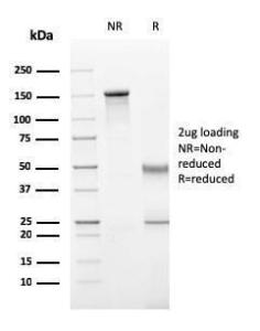 SDS-PAGE analysis of Anti-Perforin Antibody [PRF1/2470] under non-reduced and reduced conditions; showing intact IgG and intact heavy and light chains, respectively. SDS-PAGE analysis confirms the integrity and purity of the antibody.