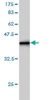 Anti-SNX1 Mouse Monoclonal Antibody [clone: 6H1]