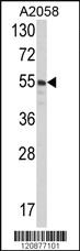 Anti-PDIA3 Rabbit Polyclonal Antibody