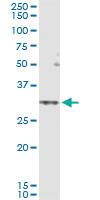 Anti-SLC25A5 Polyclonal Antibody Pair