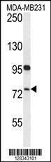 Anti-HFM1 Rabbit Polyclonal Antibody (AP (Alkaline Phosphatase))