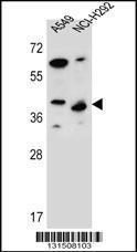 Anti-PPP1R42 Rabbit Polyclonal Antibody (Biotin)