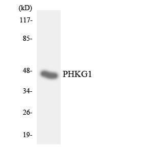 Anti-PHKG1 Rabbit Polyclonal Antibody