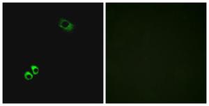 Immunofluorescence analysis of MCF7 cells using Anti-GPRC6A Antibody. The right hand panel represents a negative control, where the antibody was pre-incubated with the immunising peptide