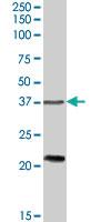 Anti-TUSC3 Goat Polyclonal Antibody