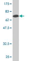 Anti-ZFYVE19 Mouse Monoclonal Antibody [clone: 3G4-2B11]