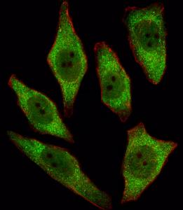 Anti-APRT Rabbit Polyclonal Antibody (Biotin)