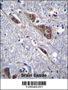 Anti-ELAVL2 Rabbit Polyclonal Antibody (AP (Alkaline Phosphatase))