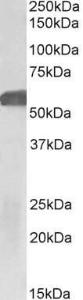 Anti-GLP1R antibody