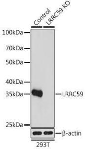 Anti-LRRC59 antibody