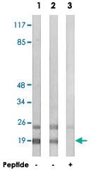 Anti-RPL12 Rabbit Polyclonal Antibody