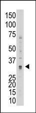 Anti-Matrix Metalloproteinase 7 Rabbit Polyclonal Antibody