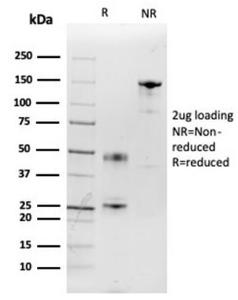 SDS-PAGE analysis of Anti-IL-2 Antibody [IL2/3949] under non-reduced and reduced conditions; showing intact IgG and intact heavy and light chains, respectively. SDS-PAGE analysis confirms the integrity and purity of the antibody.