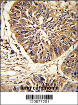 Anti-PDIA3 Rabbit Polyclonal Antibody