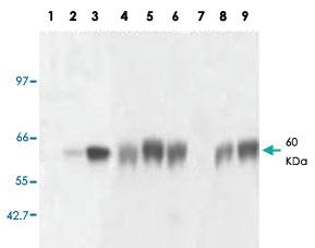 Anti-GNRHR Mouse Monoclonal Antibody [clone: AT2.G7]