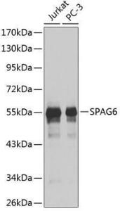 Antibody anti-SPAG6 100 µl