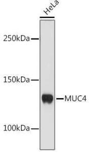 Western blot analysis of extracts of HeLa cells, using Anti-MUC4 Antibody [ARC1999] (A309154) at 1:1000 dilution. The secondary Antibody was Goat Anti-Rabbit IgG H&L Antibody (HRP) at 1:10000 dilution. Lysates/proteins were present at 25 µg per lane