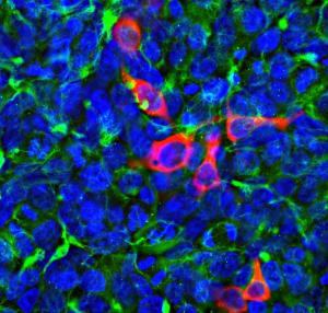 Immunofluorescent analysis of HEK293 cells transfected with pCI-Neo-Mod vector including DNA encoding the Cas-Phi protein, stained with Anti-Cas-phi Antibody [5F95] (A270595), dilution 1:2,000, in red, and co-stained with Anti-Vimentin Antibody (A85420), dilution 1:2,000, in green