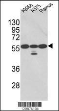 Anti-PDIA3 Rabbit Polyclonal Antibody