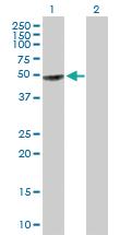 Anti-GART Mouse Polyclonal Antibody