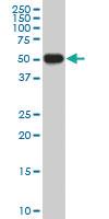 Anti-CRLF1 Mouse Monoclonal Antibody [clone: 5C2]