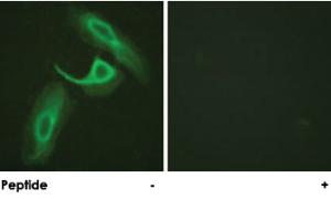 Anti-ITGB2 Rabbit Polyclonal Antibody