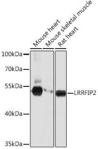 Anti-LRRFIP2 antibody