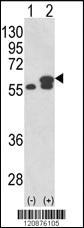 Anti-PDIA3 Rabbit Polyclonal Antibody