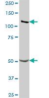 Anti-GART Mouse Polyclonal Antibody