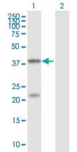 Anti-EV71 VP1 Mouse Polyclonal Antibody