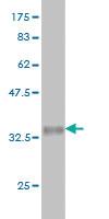 Anti-CDK1 Mouse Monoclonal Antibody [clone: 1G10]