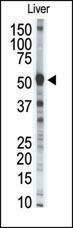 Anti-MMP8 Rabbit Polyclonal Antibody (APC (Allophycocyanin))