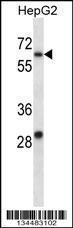 Anti-KCNC1 Rabbit Polyclonal Antibody (AP (Alkaline Phosphatase))